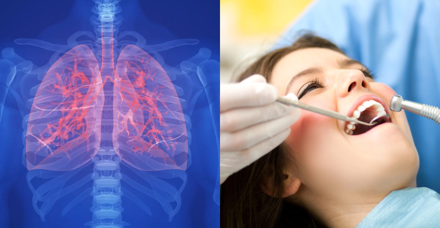Pulmonary Fibrosis and Dental Health inblog